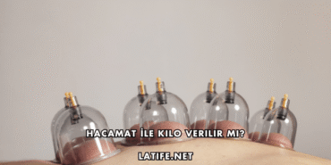 Hacamat İle Kilo Verilir mi?