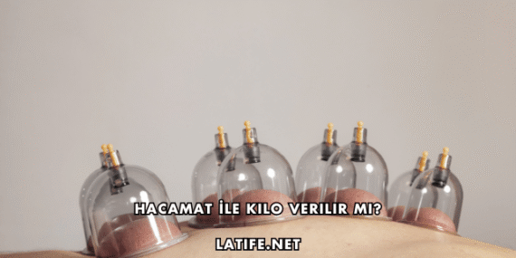 Hacamat İle Kilo Verilir mi?